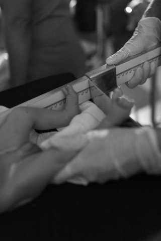 Измерение длины новорожденного в клинической обстановке с вниманием со стороны медицинского работника